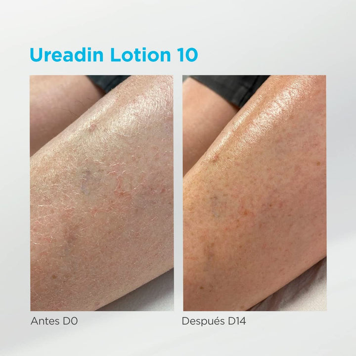 ISDIN Ureadin Lotion 10 (1000ml) | Loțiune de corp cu hidratare intensivă pentru pielea uscată 10% uree Copii - Baie si Skincare Naty Shop